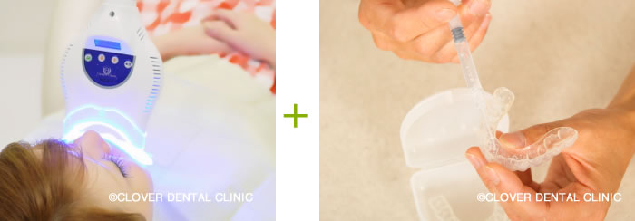 ホワイトニング | 登戸クローバー歯科・矯正歯科 川崎市多摩区の歯医者