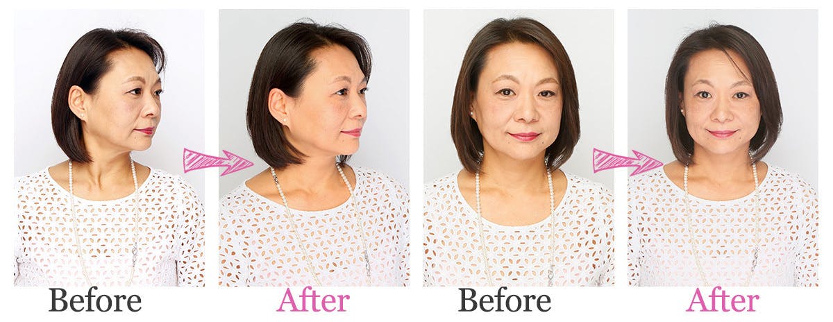 ケイ素鉱石でできた美顔ローラー『SITERA403』 / 渋谷トレンド公式