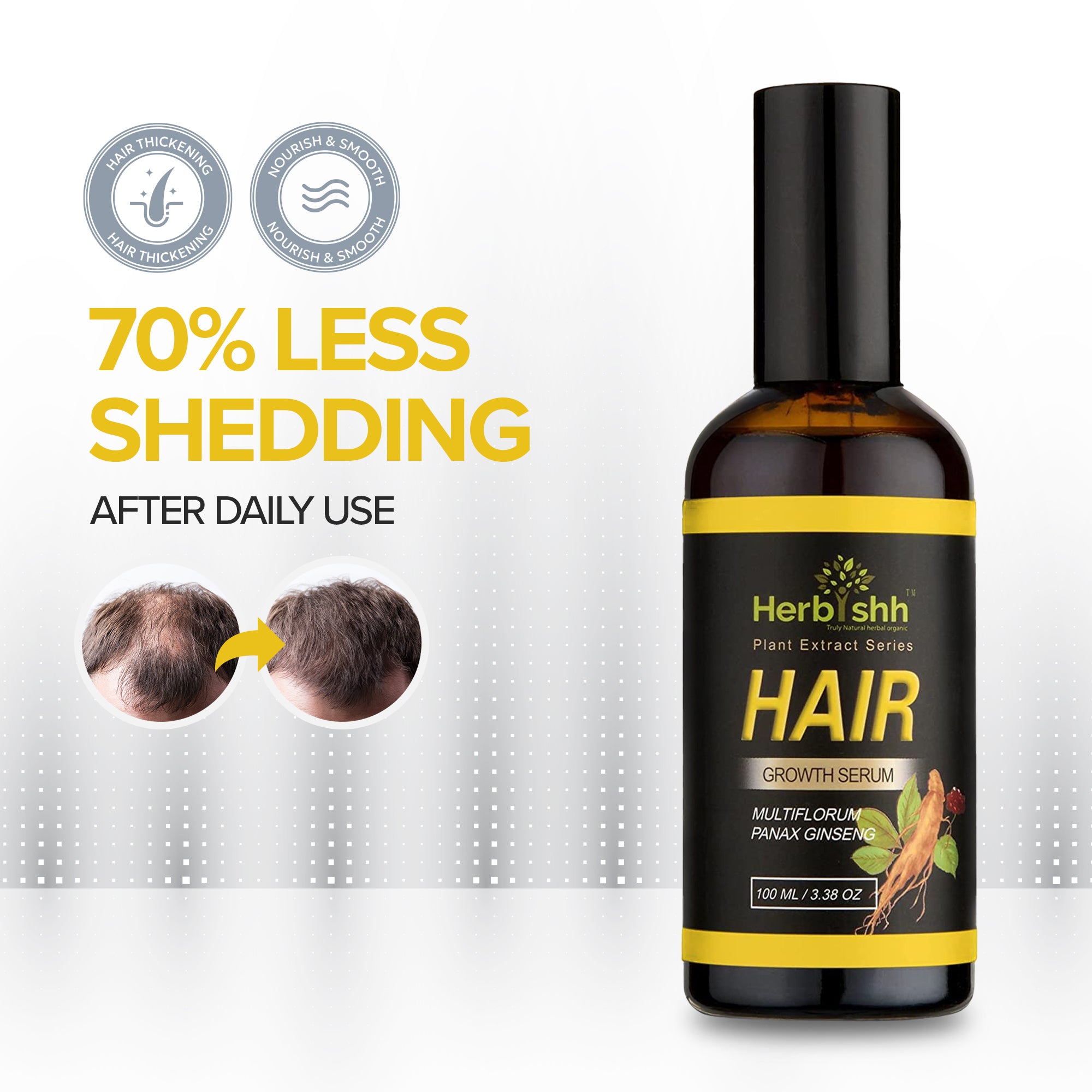 Hair-Growth-Serum.jpg?v=1763467526