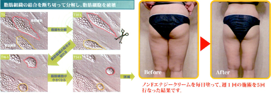 送料無料】ノンFエナジークリーム プレミアム【正規取扱店】