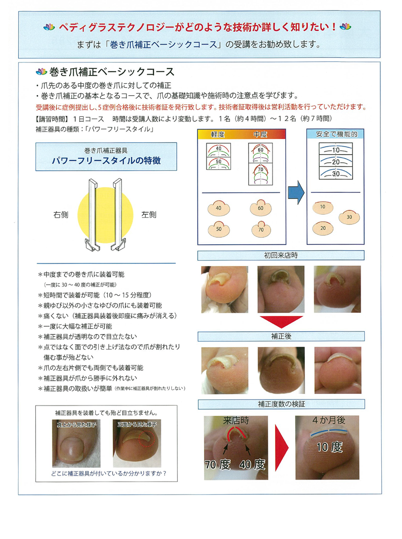 ペディグラステクノロジー｜技術を学びたい方 コース紹介 巻き爪