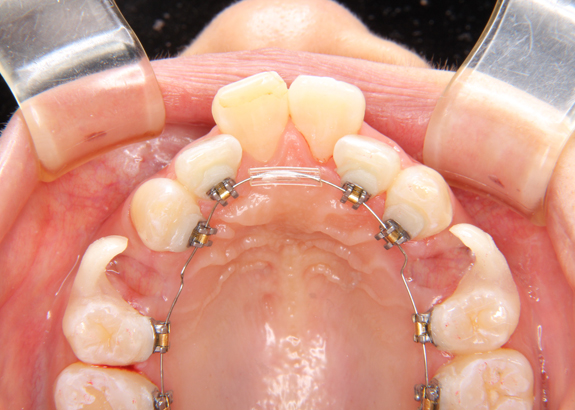 当院のこだわり | 横浜の矯正歯科はSYNC横浜元町矯正歯科