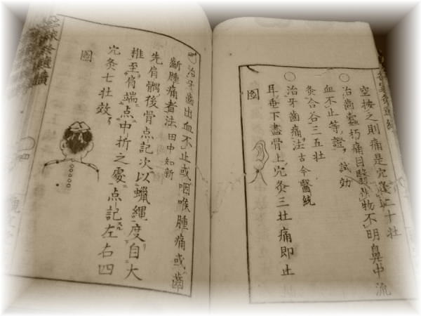 深谷灸法についての説明｜深谷伊三郎 – 蓬庵（よもぎあん）｜和歌山県