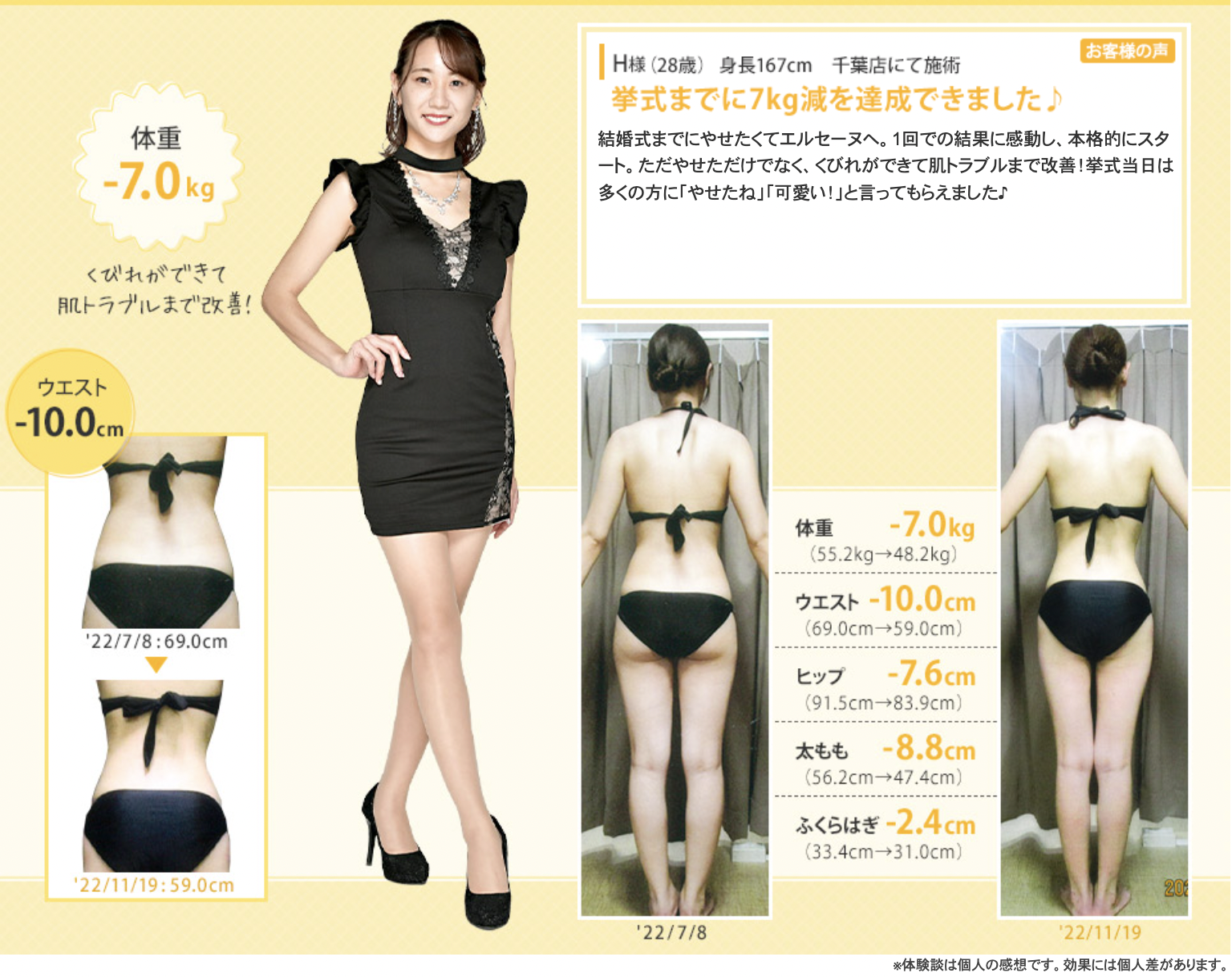 2月最新】エルセーヌ 心斎橋本店の料金・口コミ・効果から基本情報や