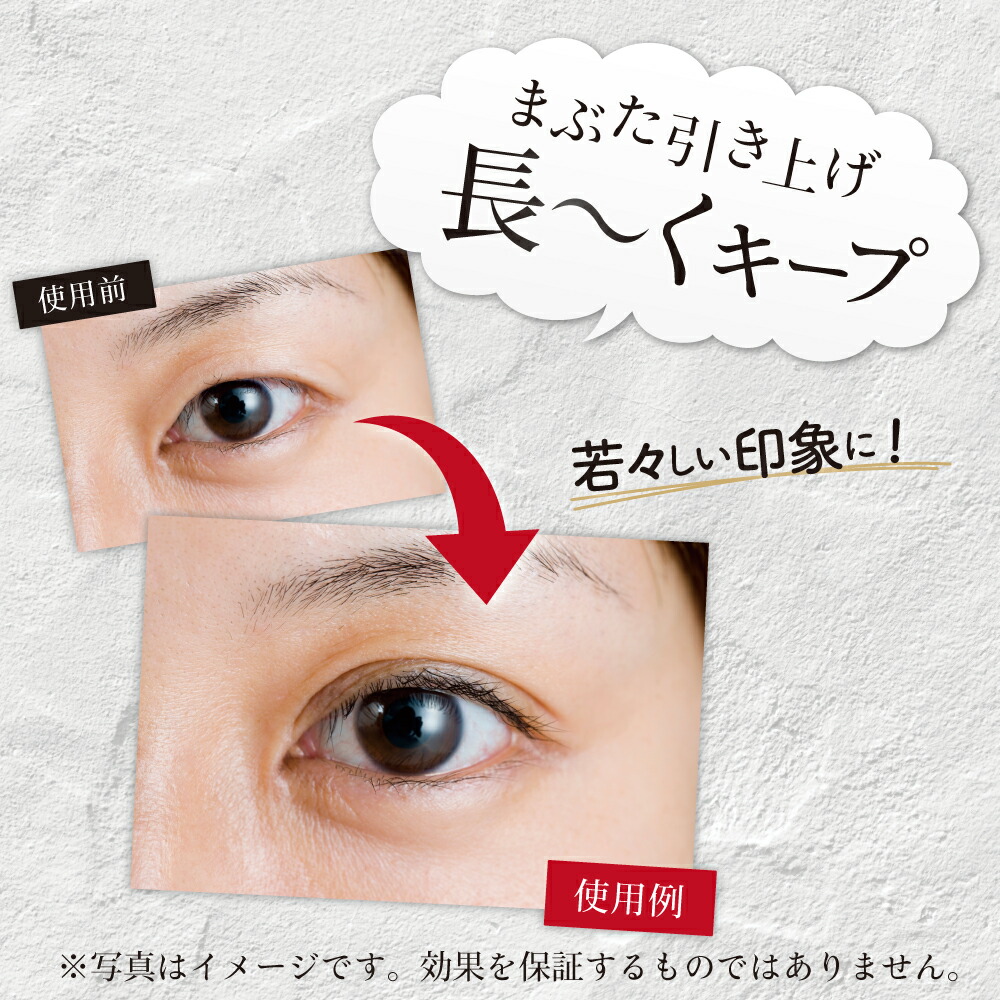 楽天市場】【100円クーポン有】視界良好DX まぶた引き上げジェル 2ml