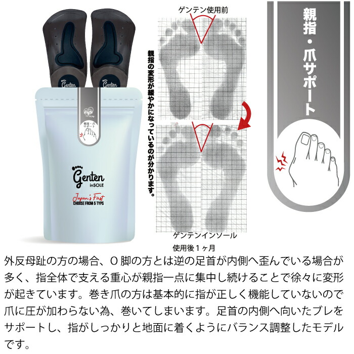 楽天市場】インソール 姿勢 矯正 靴の中敷き genten 肩こり 首の痛み