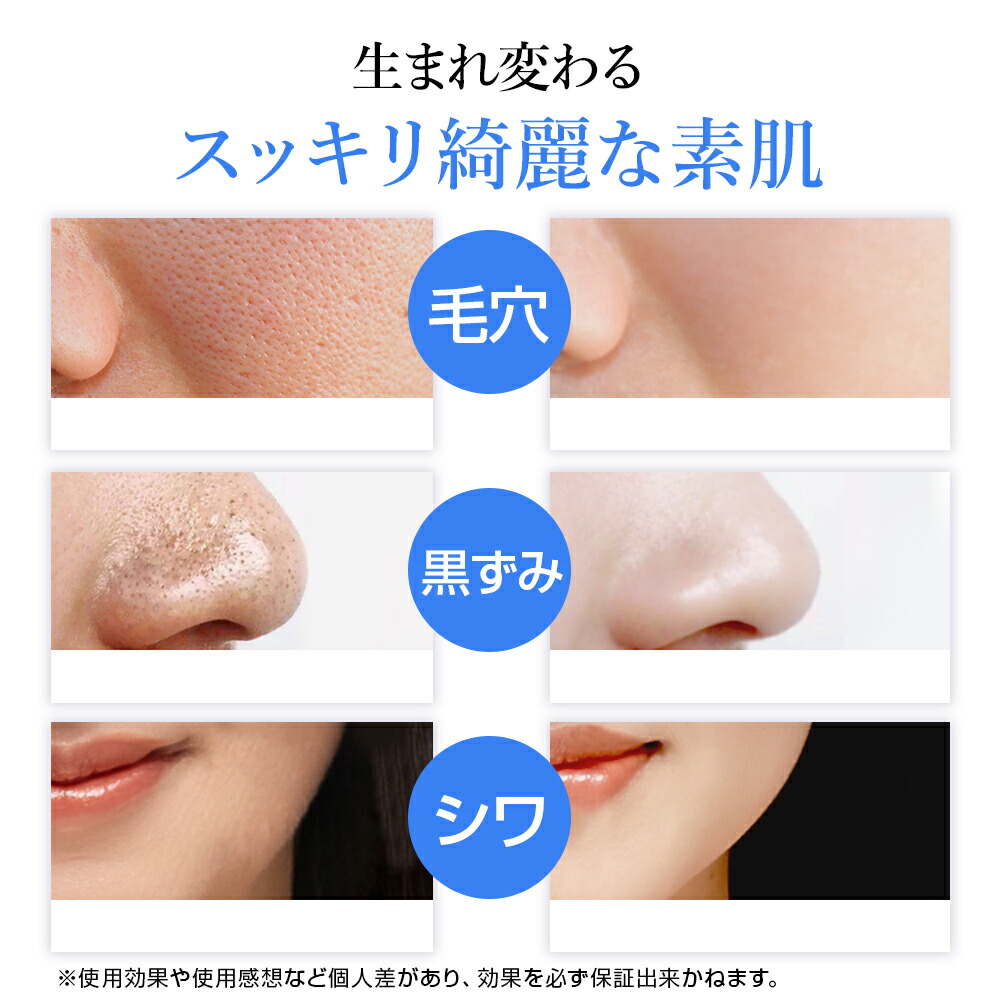 楽天市場】【楽天スーパーSALE限定特価！】ウォーターピーリング 美顔