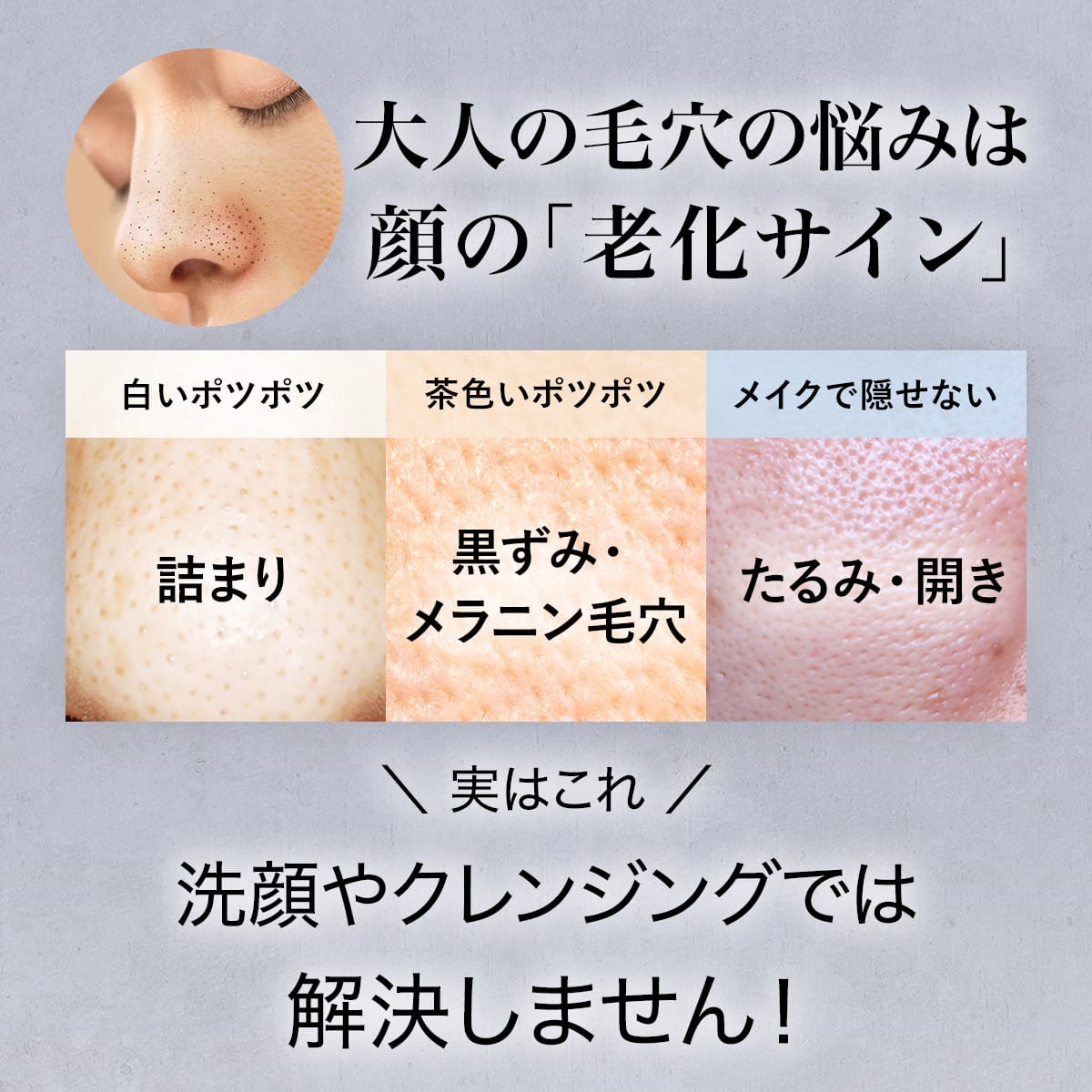 楽天市場】【公式ショップ】ビーグレン(b.glen) QuSomeレチノA 美容液