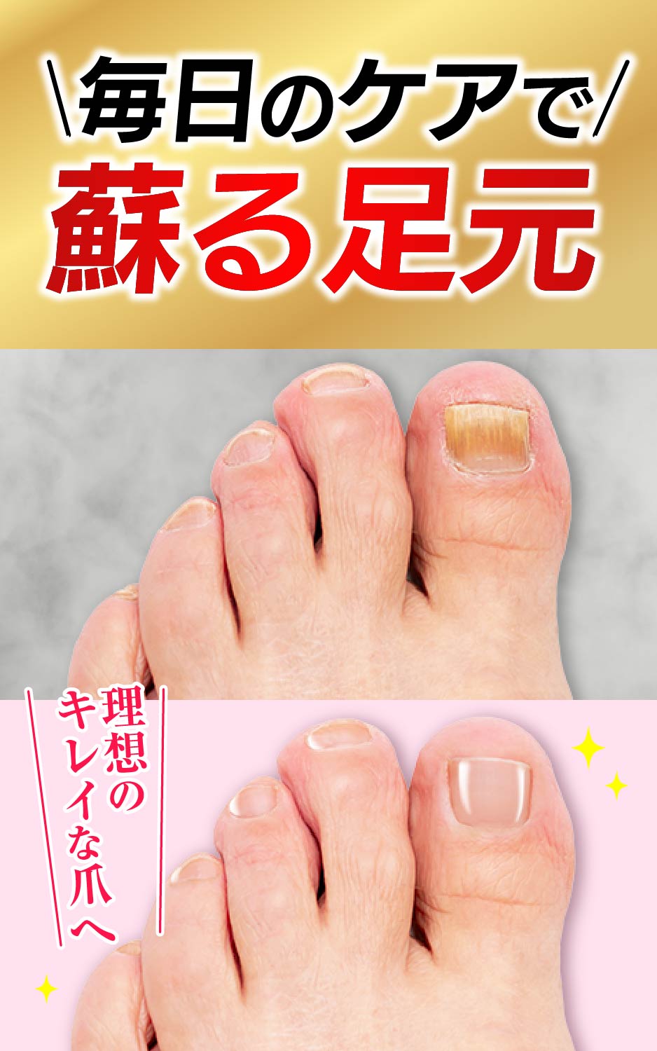 楽天市場】【55%OFF：3/11 01:59迄】公式 グロリアス製薬 Re:Bonel