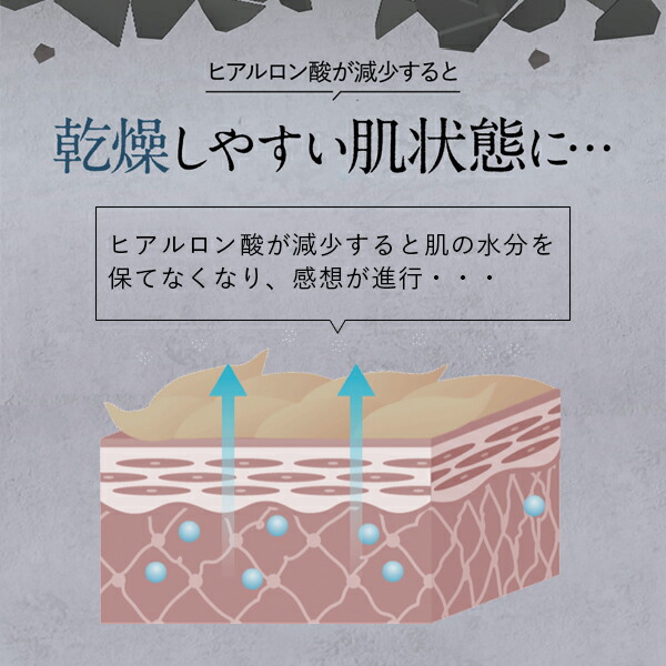 楽天市場】キユーピー キユートピア ハンデコルテ ギフトボックス （2