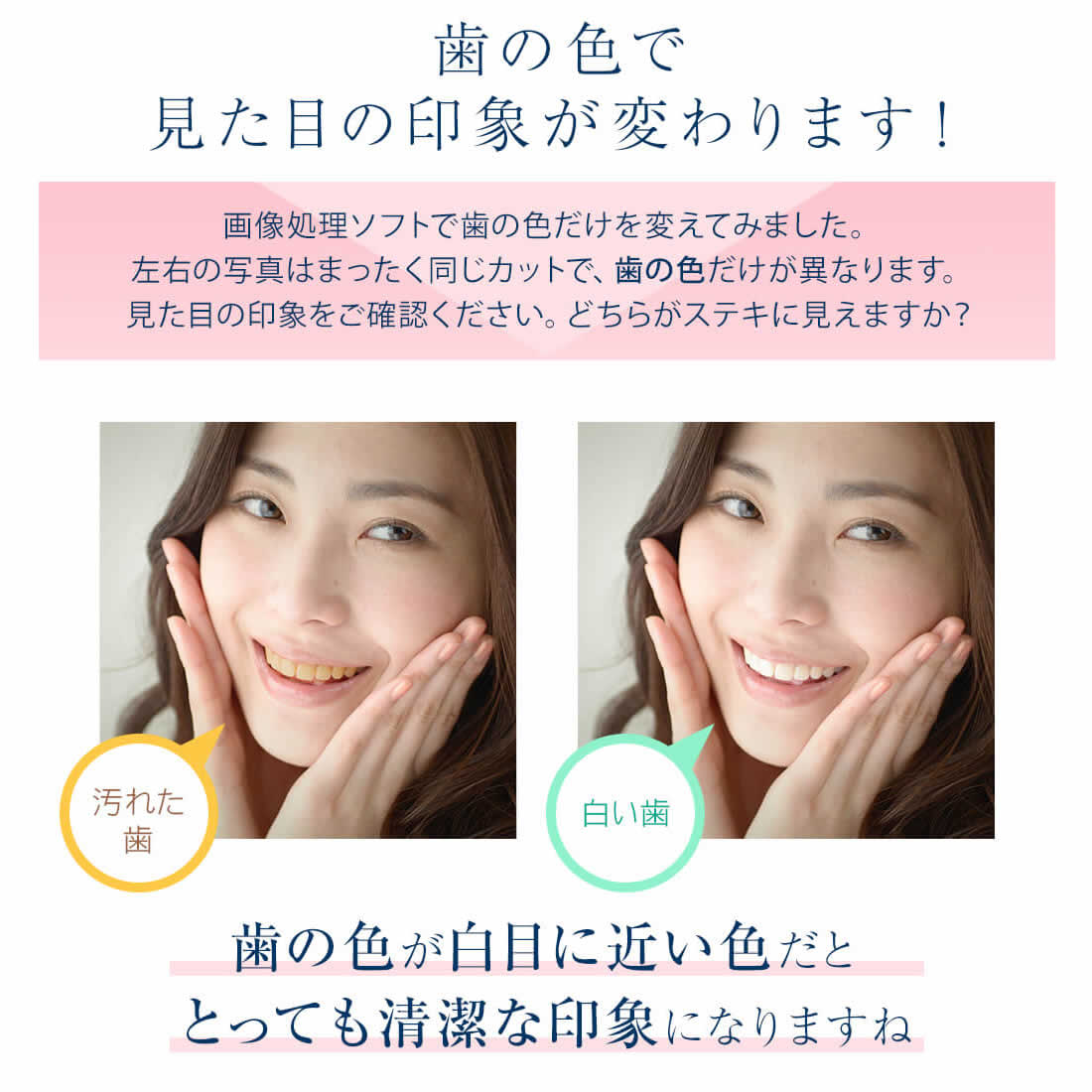 楽天市場】スマートデントII ＜一般医療機器＞【本体のみ専用 ジェル