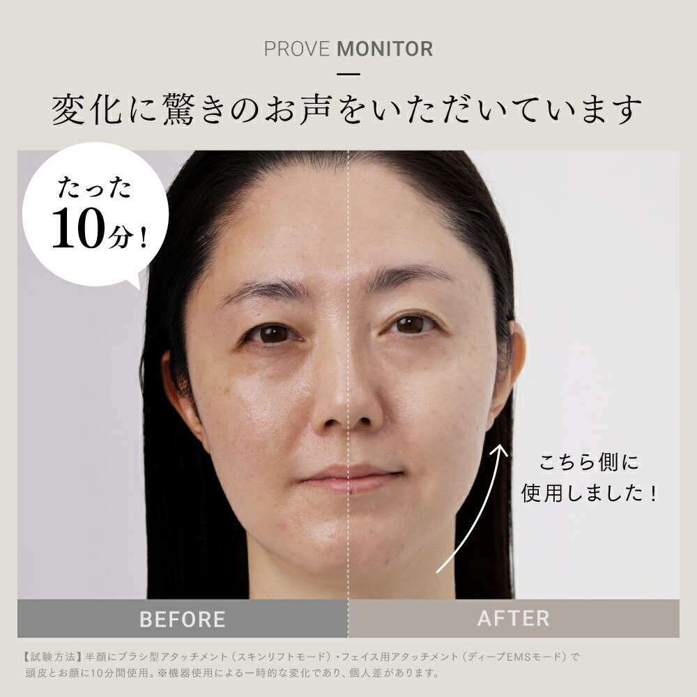 楽天市場】【公式｜3/5まで 10%OFFクーポン+P10倍！】EMS 美顔器