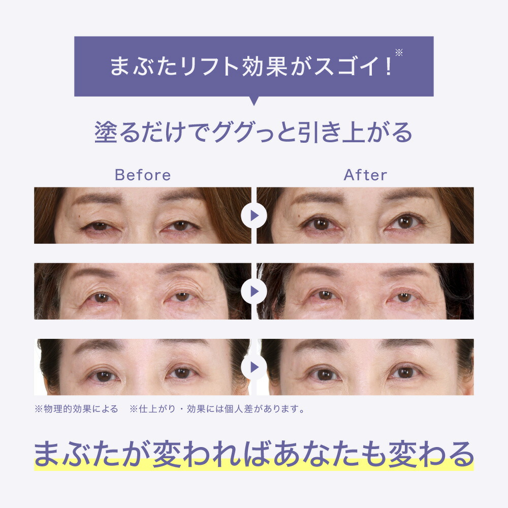 楽天市場】【20%OFFクーポン 11日1:59まで】【公式】 目元 まぶた 美容