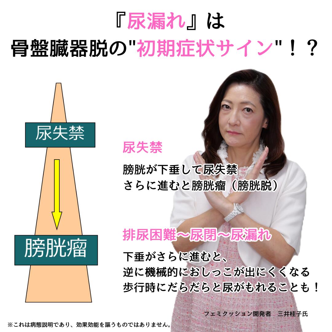 楽天市場】フェミクッション 【(らくらく) スターターキット