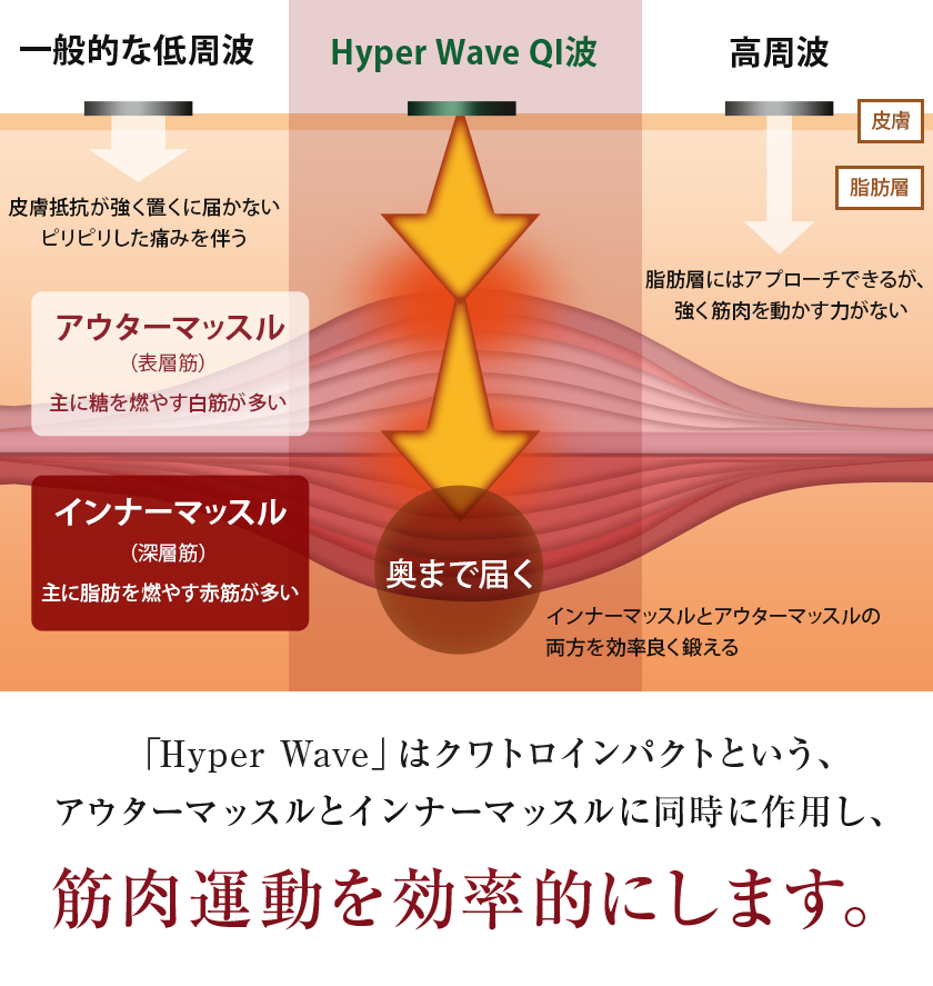 株式会社ワムのハイパーウェーブ®（QI波マシン）