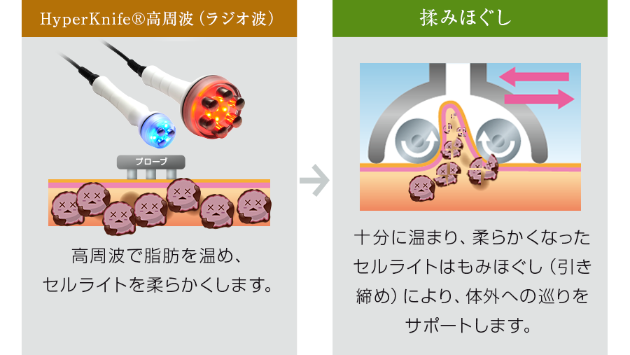 株式会社ワムのハイパーシェイプ®