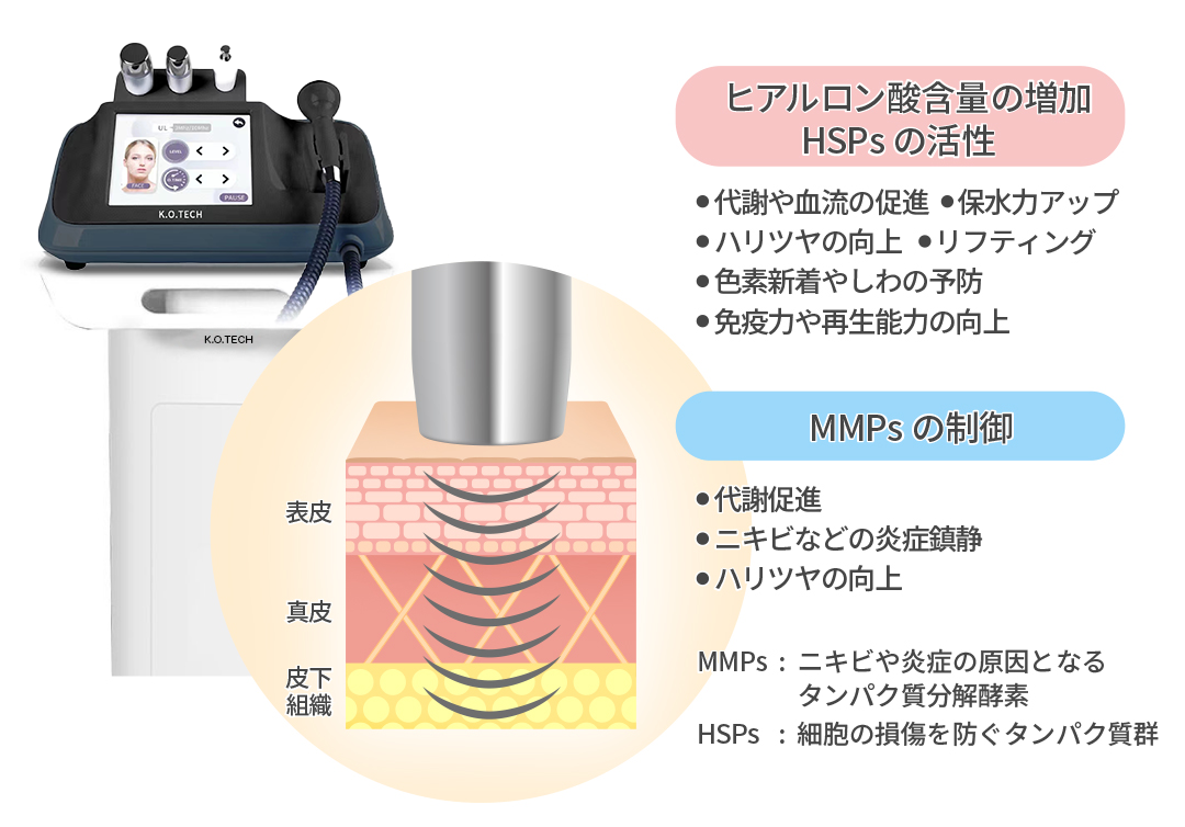 LDM(水滴リフティング)｜Wi Clinic(ウィクリニック)【公式】