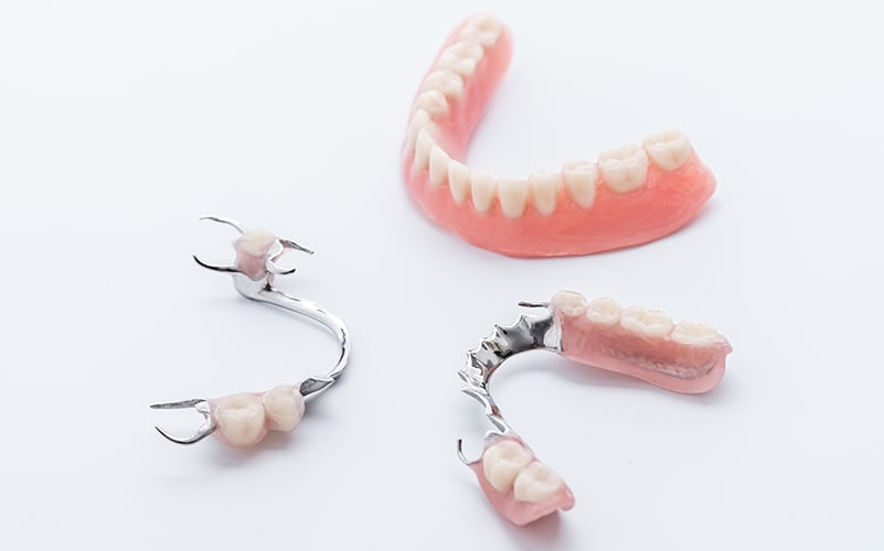 入れ歯｜大阪市中央区の歯医者「あかまつ歯科」森宮駅すぐ