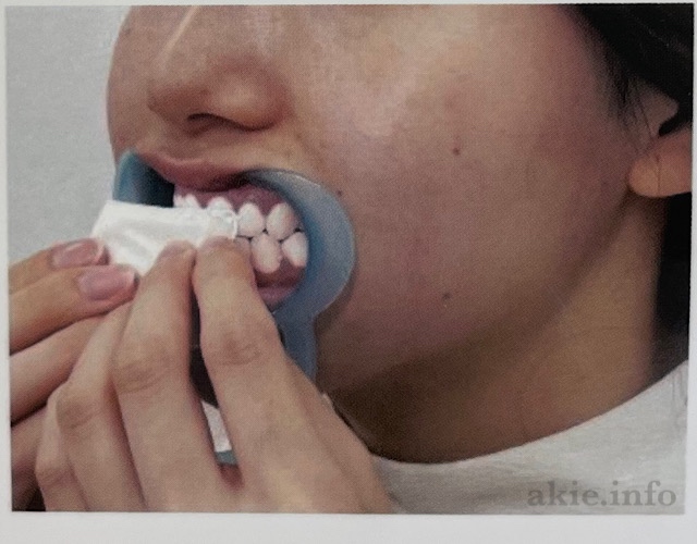 ちょこざっぷのセルフホワイトニングの頻度は？ - 楽々ママの美容時間