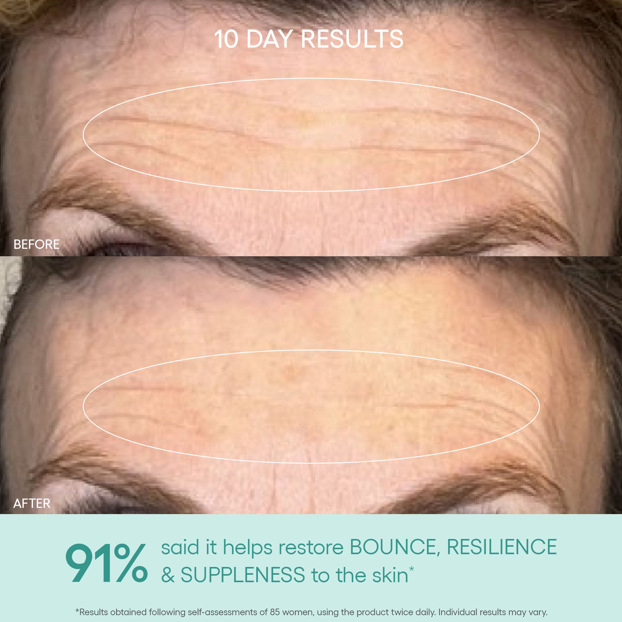 GENIUS Liquid Collagen® – Firm, Smooth & Reduce Deep Wrinkles