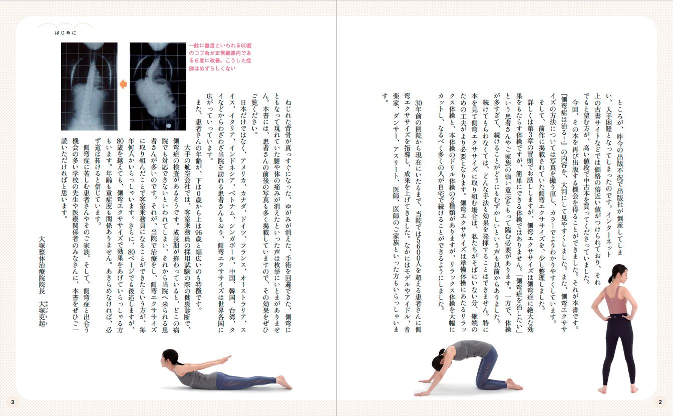 側弯症は治る！5600人のゆがみに効いた驚異のエクササイズ | 本の情報