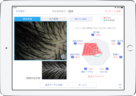 Smart Skin Care 水分計付きマイクロスコープ-美容機器の卸/仕入れなら