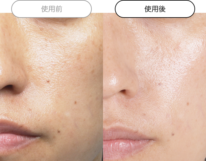 クエスクVA1セラム | スキンケア化粧品・サイエンスコスメのビーグレン