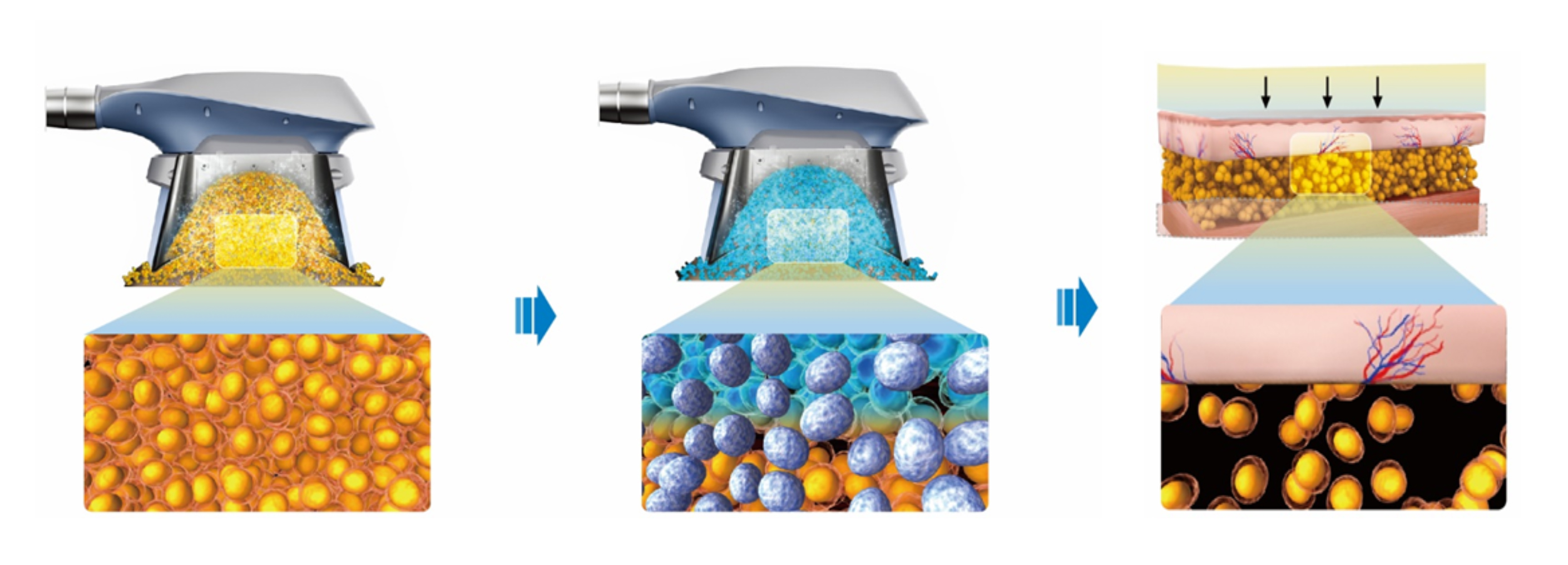 クラツーアルファ（CLATUU-α）｜美肌・若返りのドーズ美容外科【佐賀