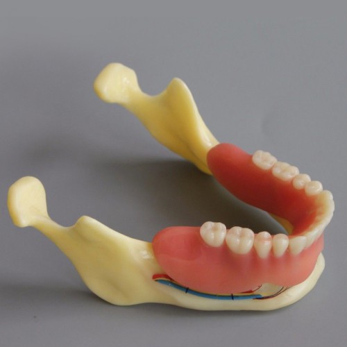 歯周病教学・説明用模型最安值通販|歯科説明・実習用模型-Dentalshop.JP