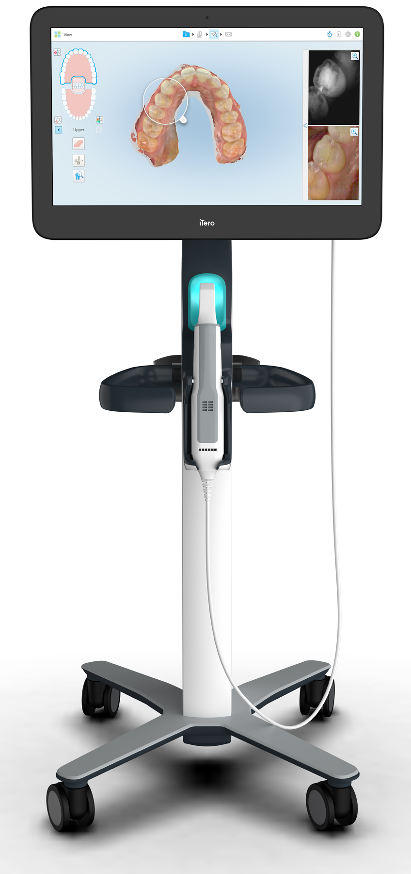 Expand your possibilities – iTero エレメント5Dプラスで広がる可能性