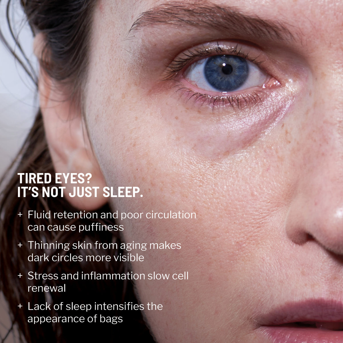 Best Eye Bag Cream for Dark Circles & Puffiness | Try Now - Dr