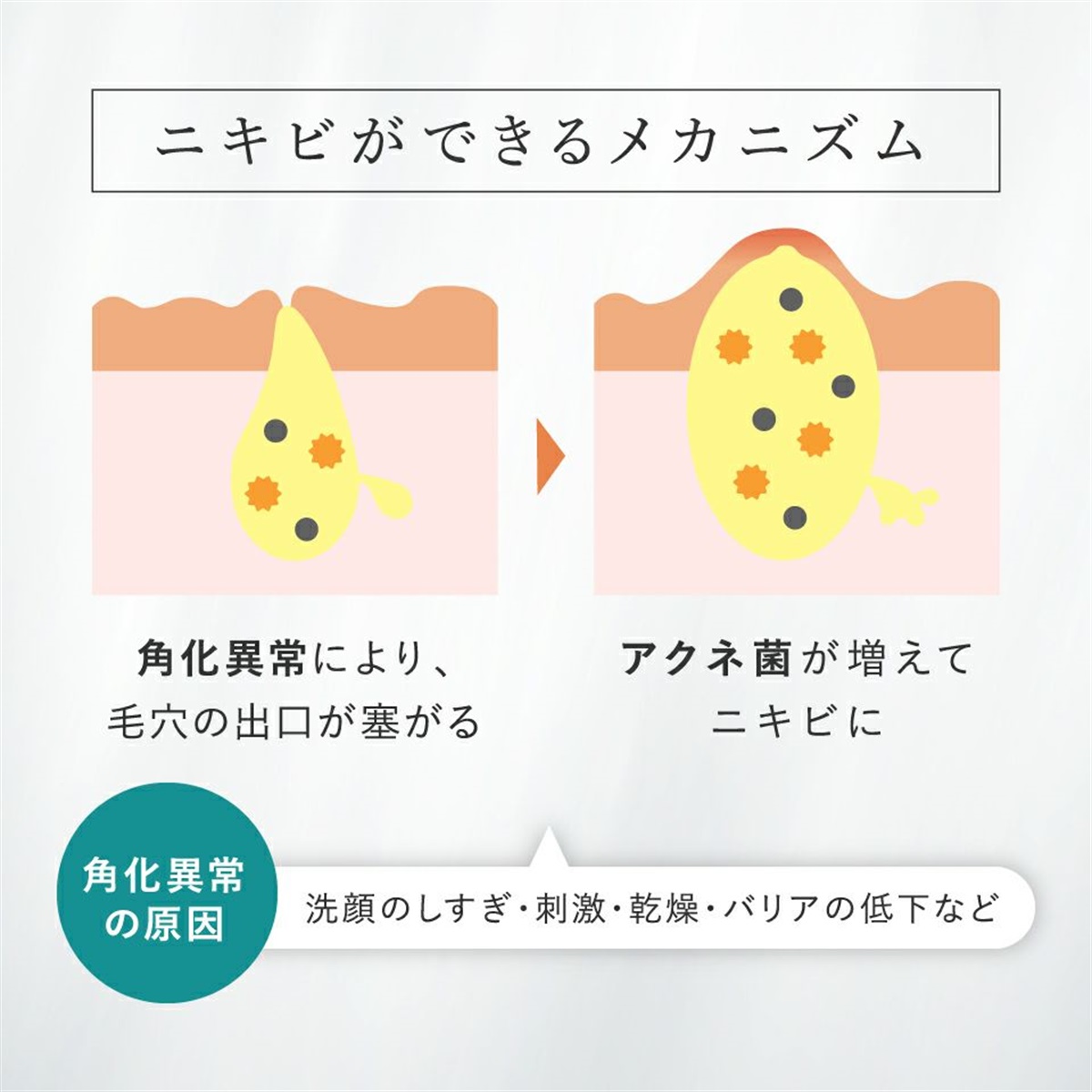 初回価格】アドバンストエッセンスAZミニ(10mL)＜美容液＞ | ミニ