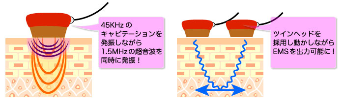 廃盤【キャビ+EMS】ベルファム CaviMAX(ベルファム キャビマックス)の