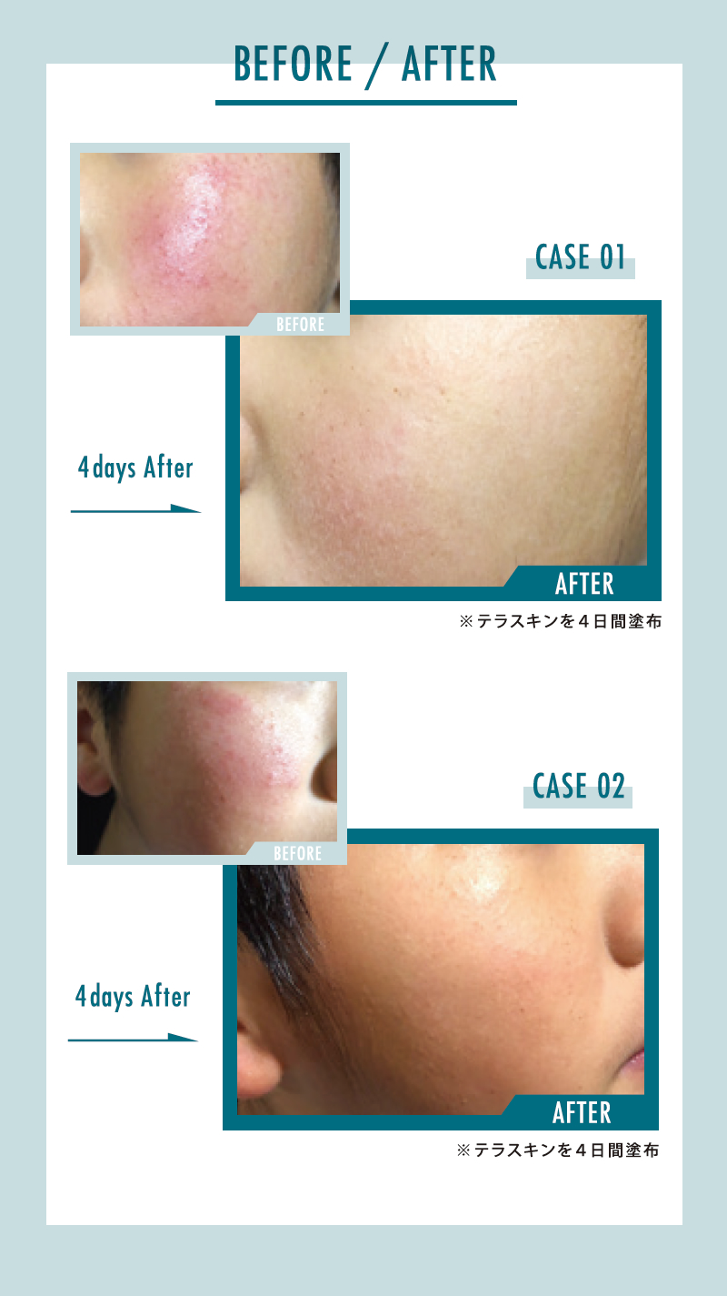 日本正規取扱店】クリスティーナ テラスキン ラインリペア (CHRISTINA