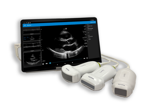 超音波画像診断装置 iViz air リニア | フクダ電子