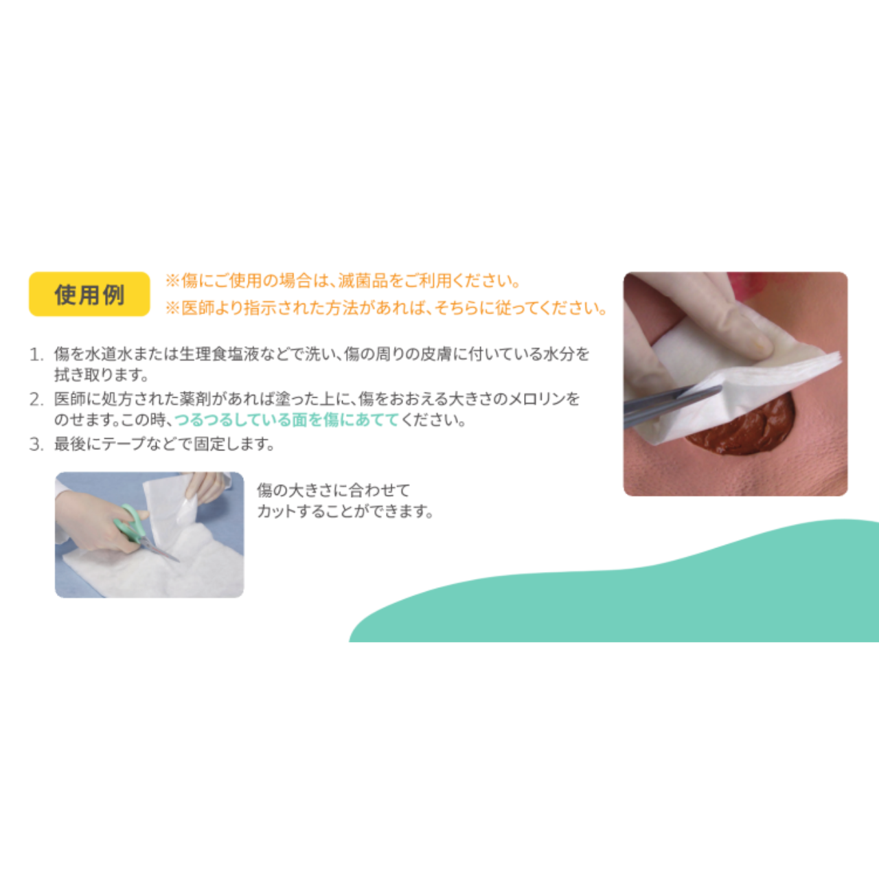 メロリン ガーゼ (滅菌済) 50×50mm 25枚入(50×50mm 25枚入): 通常