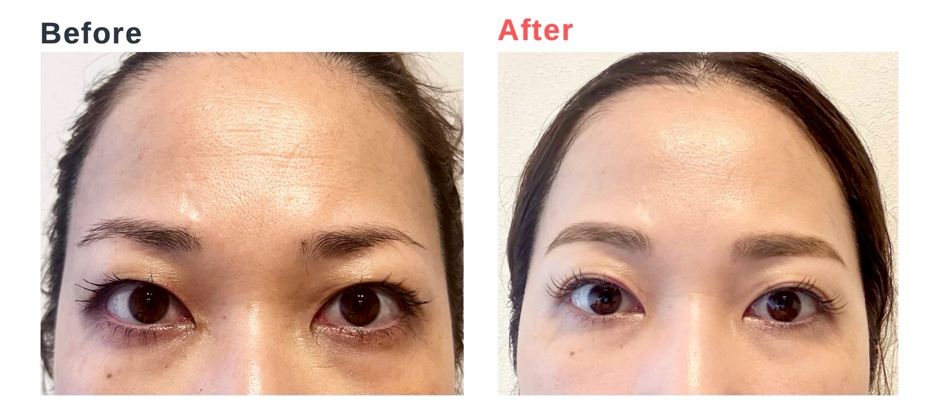 ヒロ銀座に「マンハッタンピーリフト」登場！眼科医も進める目元専門