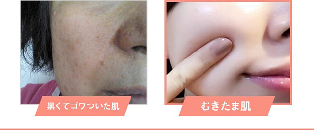 むきたま肌ジェルyawari｜肌のピンチを救うピンチ肌化粧品 I'm PINCH