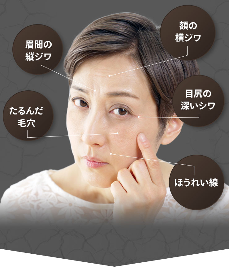 I'm PINCH夜用クリーム｜肌のピンチを救うピンチ肌化粧品 I'm PINCH