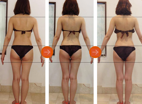 ハイパーナイフ仕組み 効果 禁忌｜エスペランサ中目黒・新宿・銀座