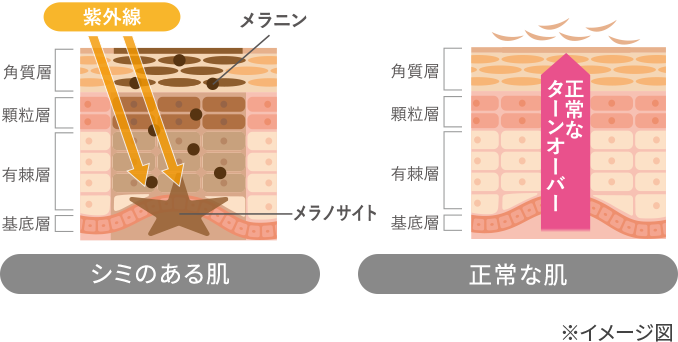 美肌パーフェクトセット（4品） | 薬用化粧品 フジナ エクセレント