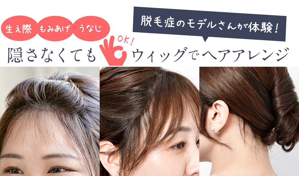 ウィッグでできるヘアアレンジ · 医療用ウィッグ専門店のワンステップ