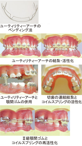 入門実習編【ベーシックコースDVD】 << 各種タイポドント矯正DVD