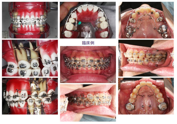 定例セミナー << 矯正実習セミナー << 矯正 セミナーのさいとう歯動塾