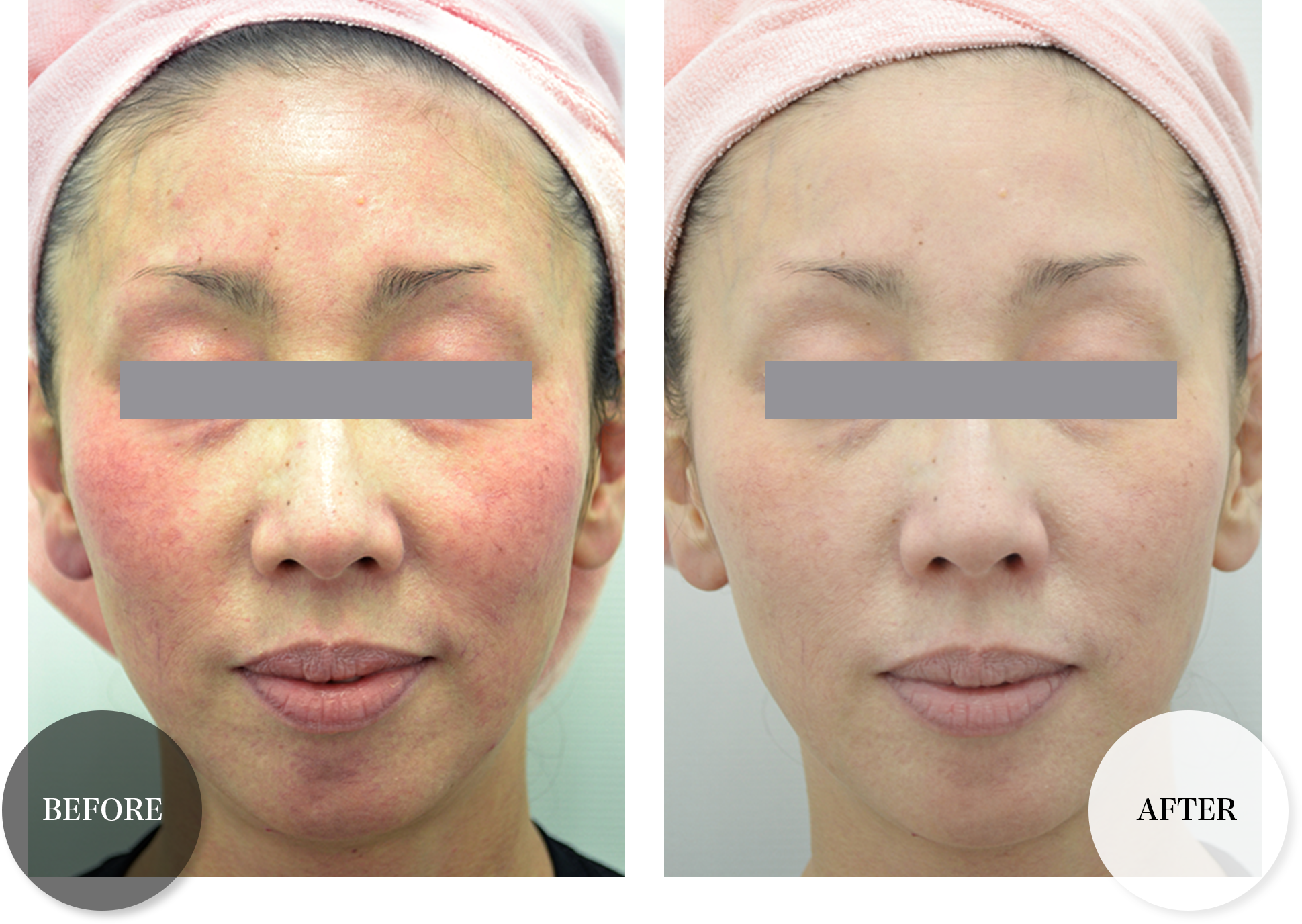 RESTORATION PACK｜MONNALI - 株式会社モナリ