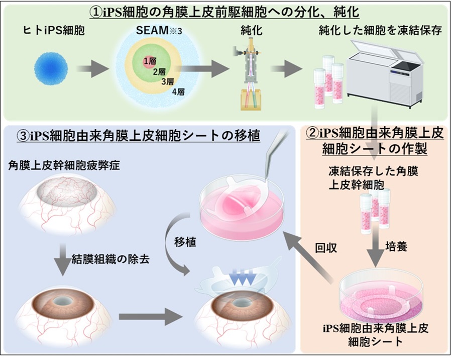 西田 幸二 ≪眼科学≫ iPS細胞から作製した角膜上皮細胞シートを移植