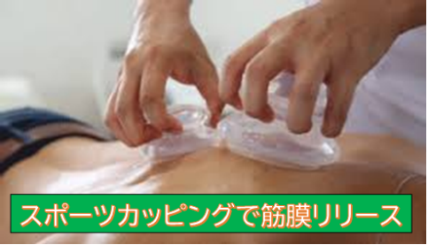 川﨑先生コラム】スポーツカッピングで筋膜リリース | 日本医専 | 柔道