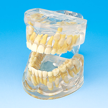 透明歯列発育模型 [PE-PDI002(P12P-100A)]｜株式会社ニッシン｜歯科