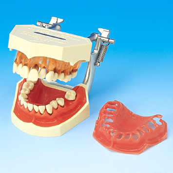 歯周病説明用顎模型 [PE-PER001(P15D-008)]｜株式会社ニッシン｜歯科