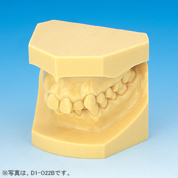 1色レジン製不正咬合顎模型 [D1D-O各種](D咬合器つき)｜株式会社